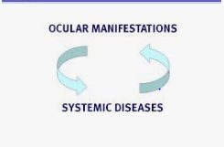 ocular manifestation of systemic diseases