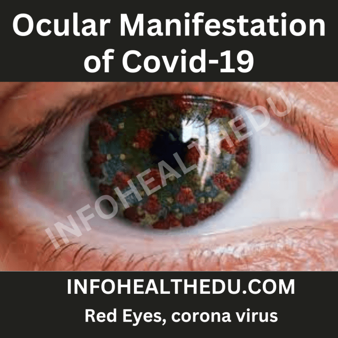 Ocular manifestation of covid 19